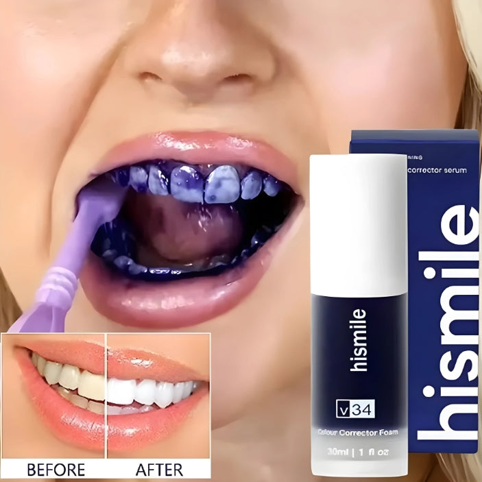 Hismile v34 Advance Teeth Whitening Serum