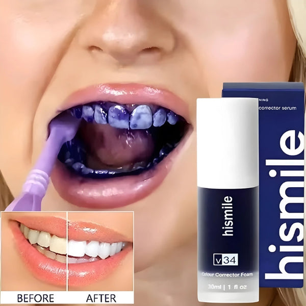 Hismile v34 Advance Teeth Whitening Serum