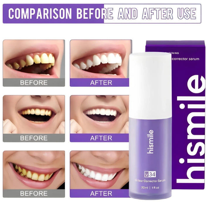 Hismile v34 Advance Teeth Whitening Serum