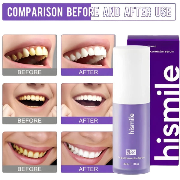 Hismile v34 Advance Teeth Whitening Serum