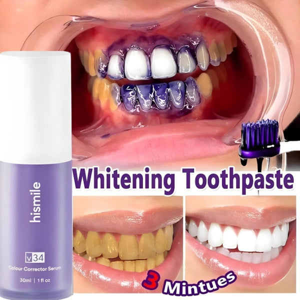Hismile v34 Advance Teeth Whitening Serum